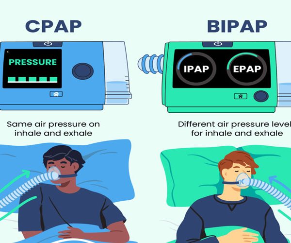 خرید دستگاه بای پپ و سی پپ در شمال تهران
